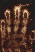 Electrografía de una mano de Hermann Schnauss, 1900 - Postal