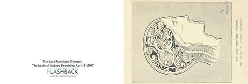 The Last Roentgen Triumph. The brain of Aubrey Beardsley unknown artist, April 8 1897 - Postcard