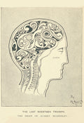 The Last Roentgen Triumph. The brain of Aubrey Beardsley unknown artist, April 8 1897 - Postcard