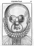 Eye Disease Treatment from Ophthalmodouleia by Georg Bartisch - 1583