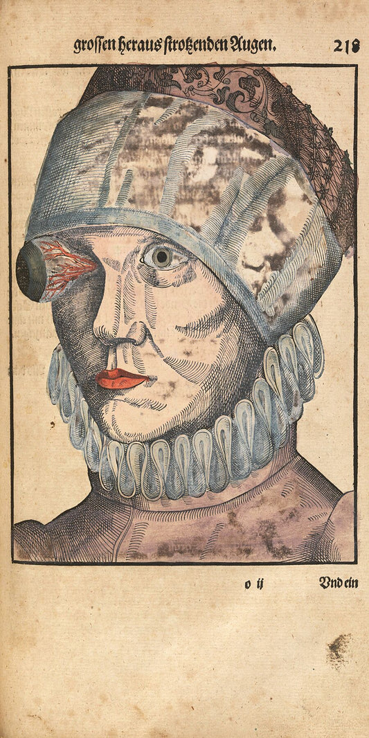 Ophthalmodouleia.  Bartisch, George, 1535-approximately 1607
