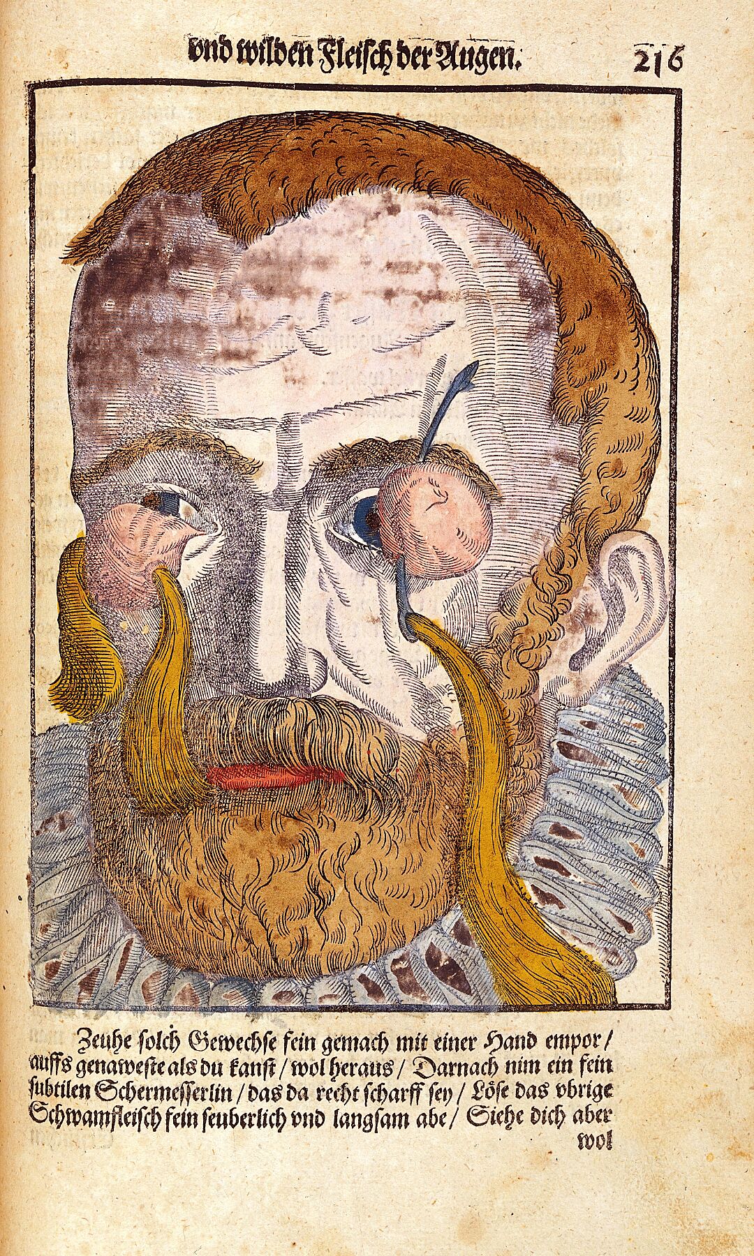 Ophthalmodouleia by Georg Bartisch - 1583