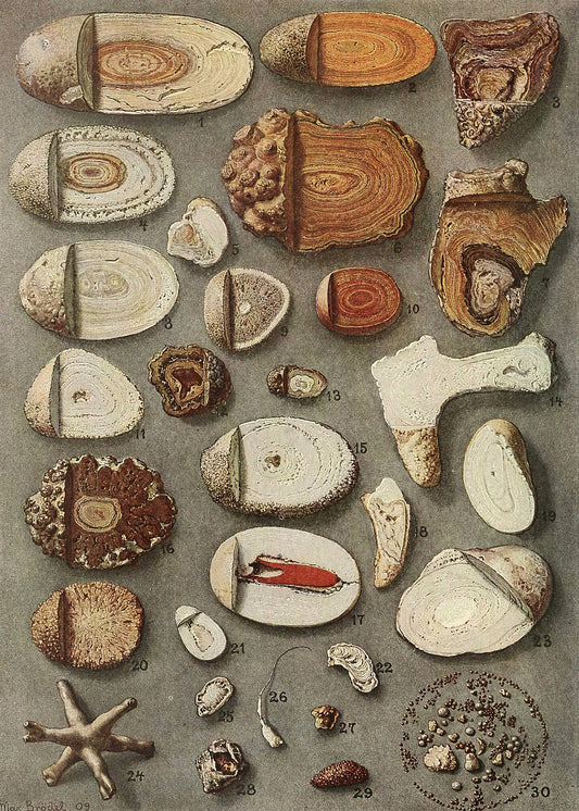 Kidney and Bladder Stones by Max Brödel, 1909 - Wrapping Paper
