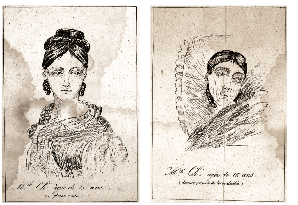 The Metamorphosis of Female Masturbation, date and artist unknown - Postcard