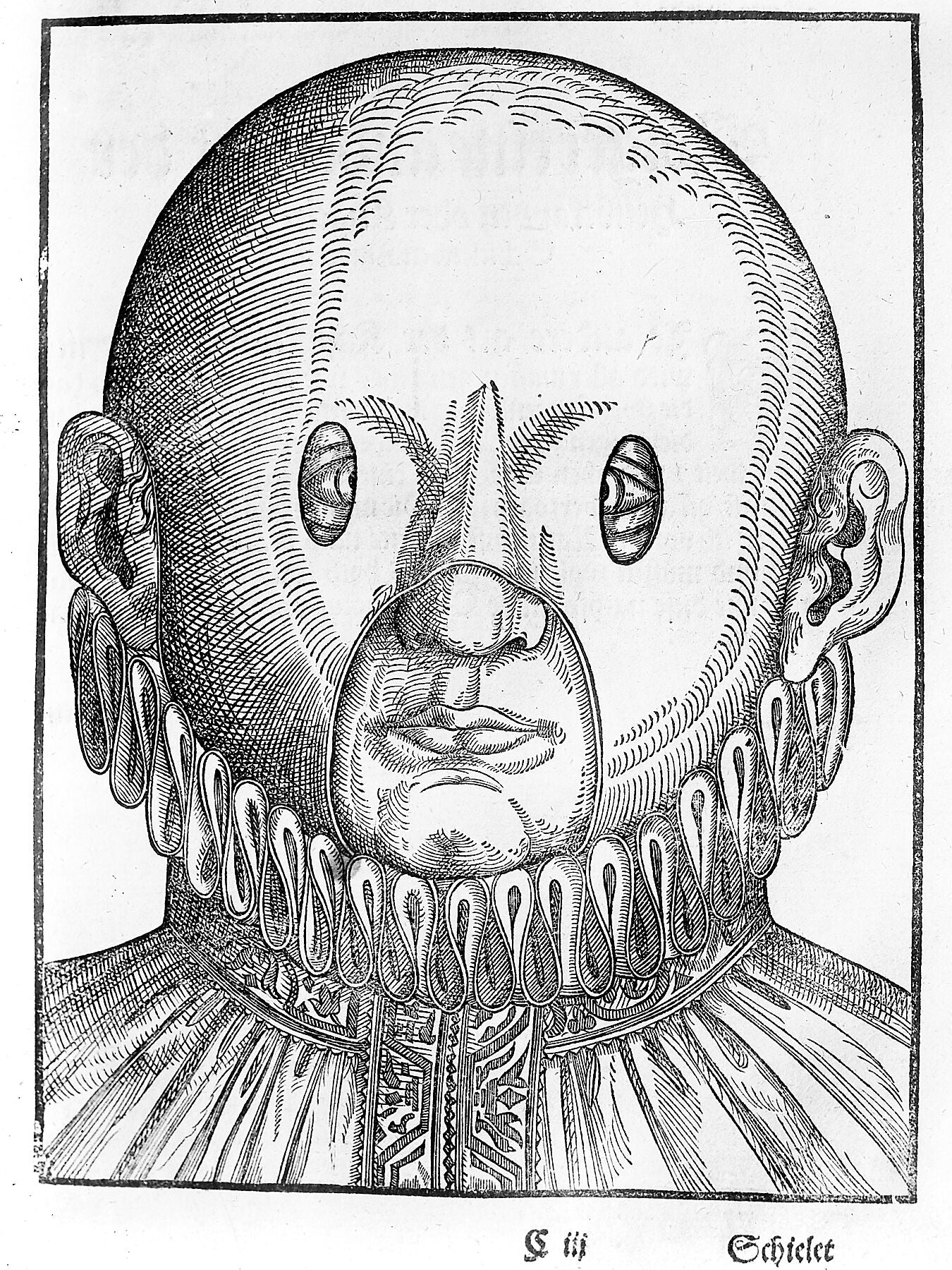 Condiciones del ojo de Ophthalmodouleia por Georg Bartisch - 1583 