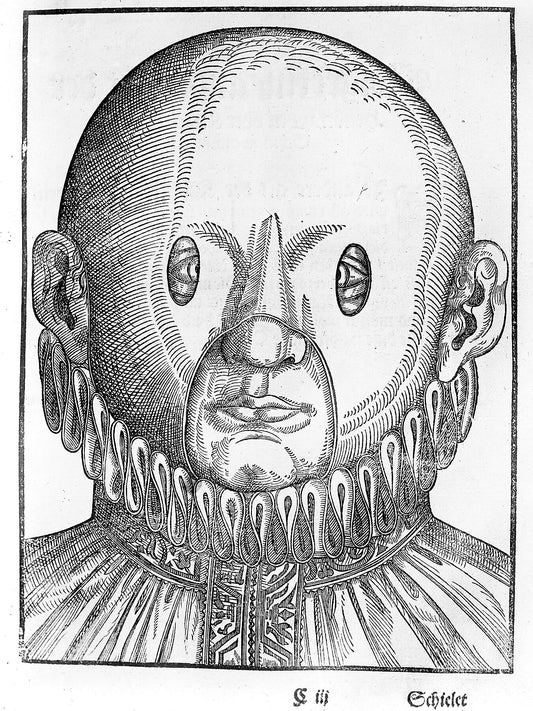 Conditions of the Eye from Ophthalmodouleia by Georg Bartisch - 1583
