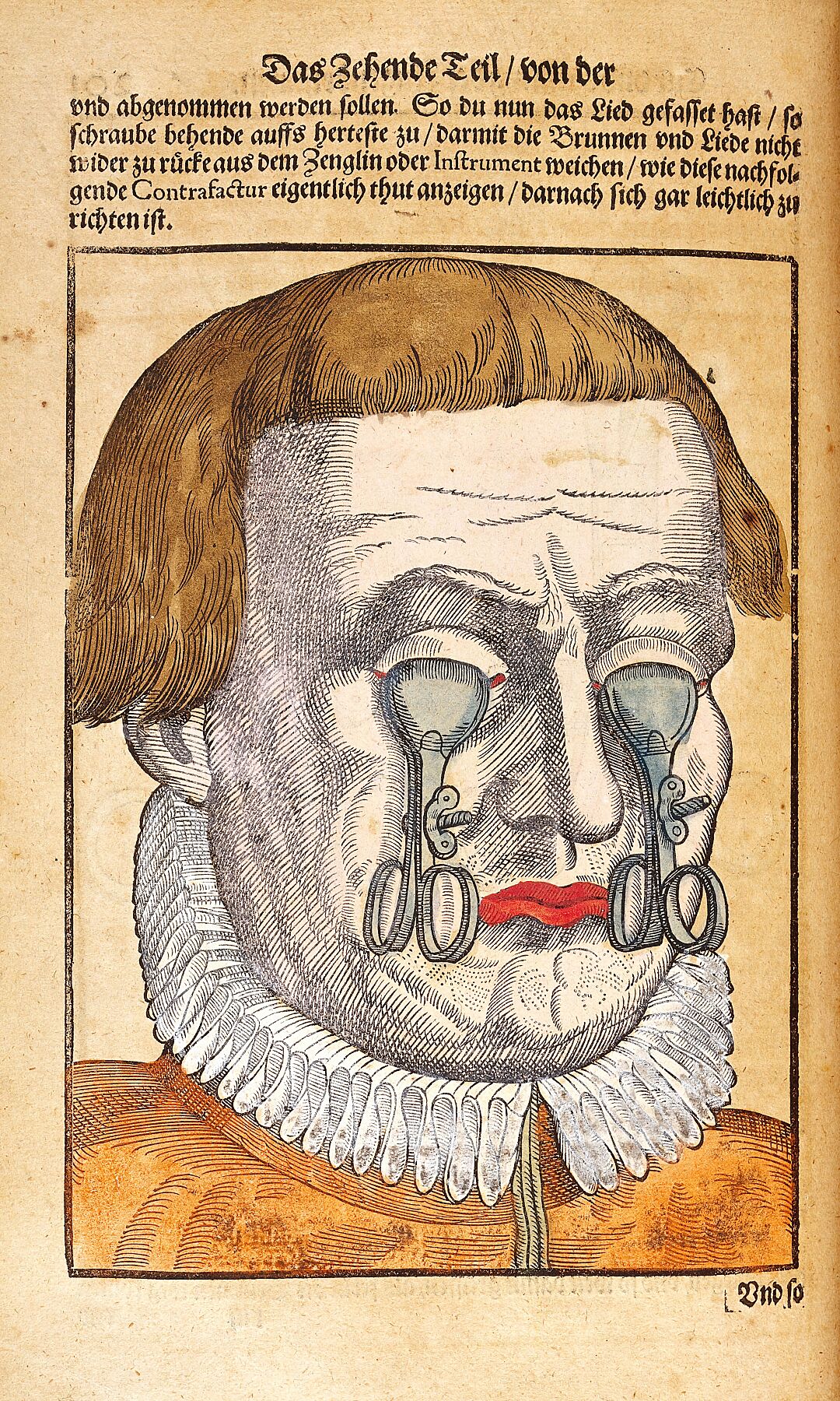 Dispositif pour garder les yeux fermés par Georg Bartisch - ch. 1583