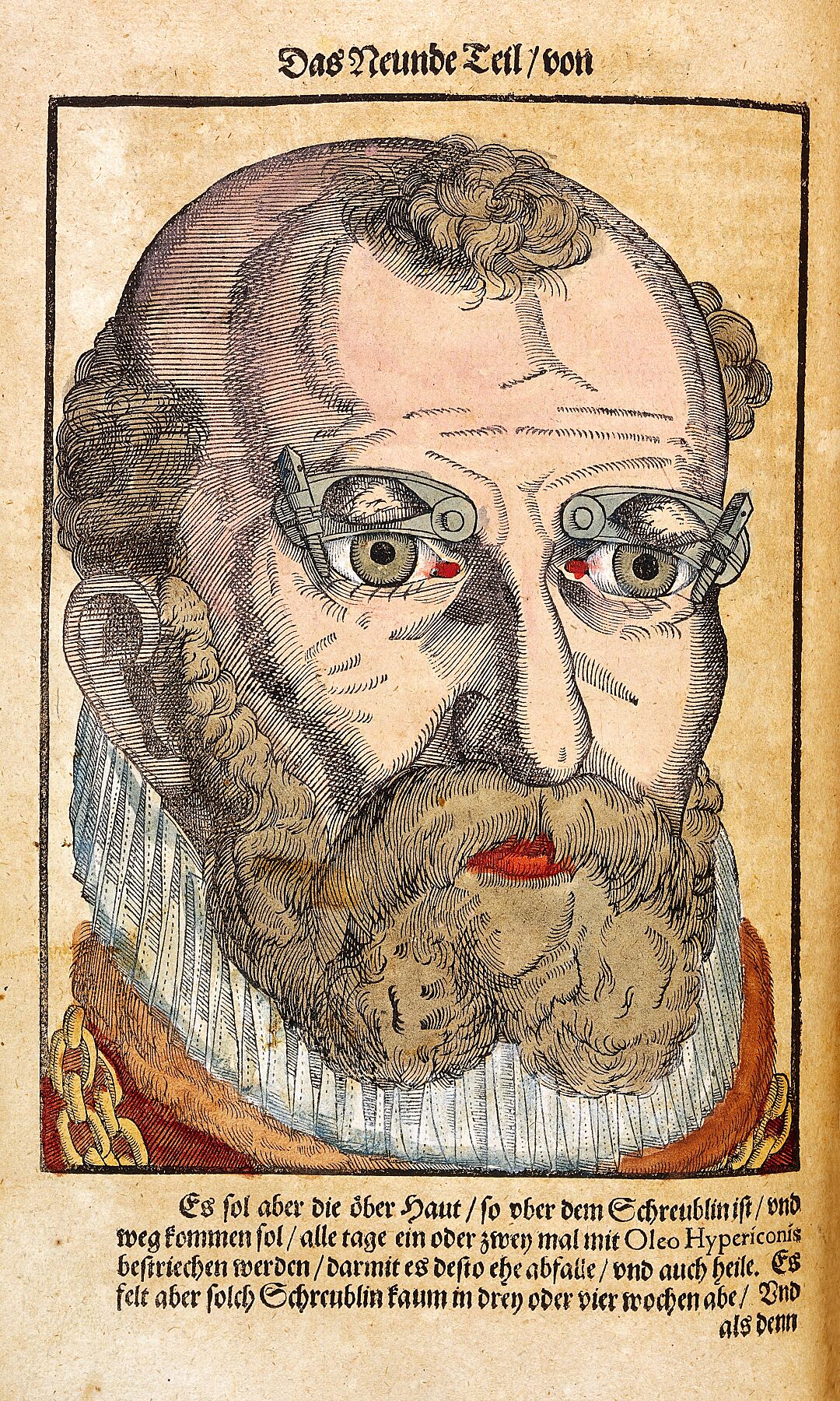 Illustration from Ophthalmodouleia by Bartisch, George - c. 1583.